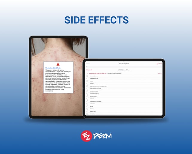 a view of the side effects module