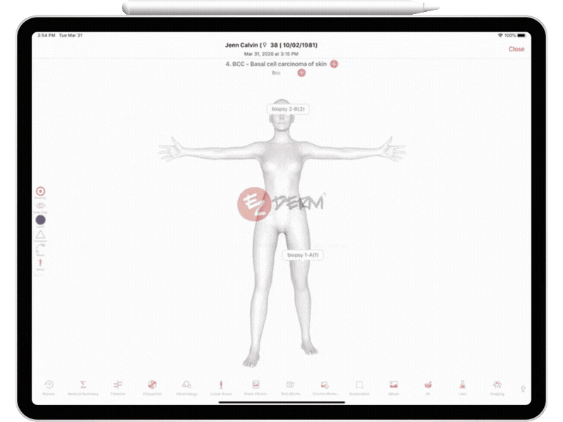 Ezderm Products – EHR – 3D Body Map