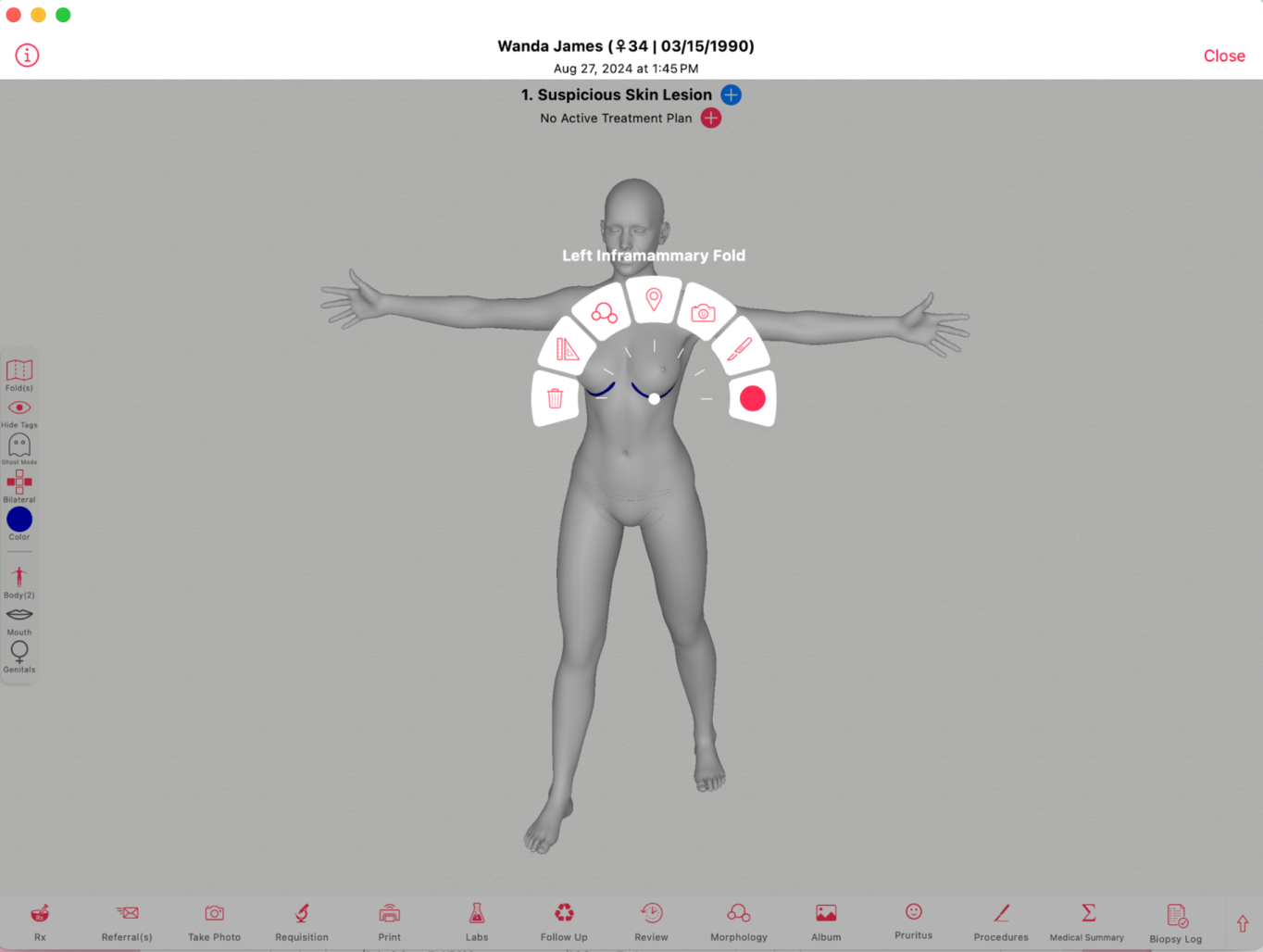 Why 3D Body Maps Are Changing Dermatology Documentation