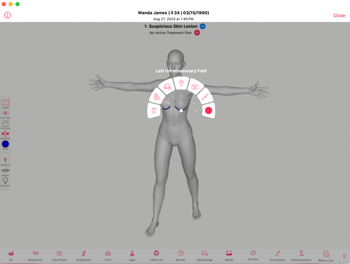 image of an ezderm 3d body map
