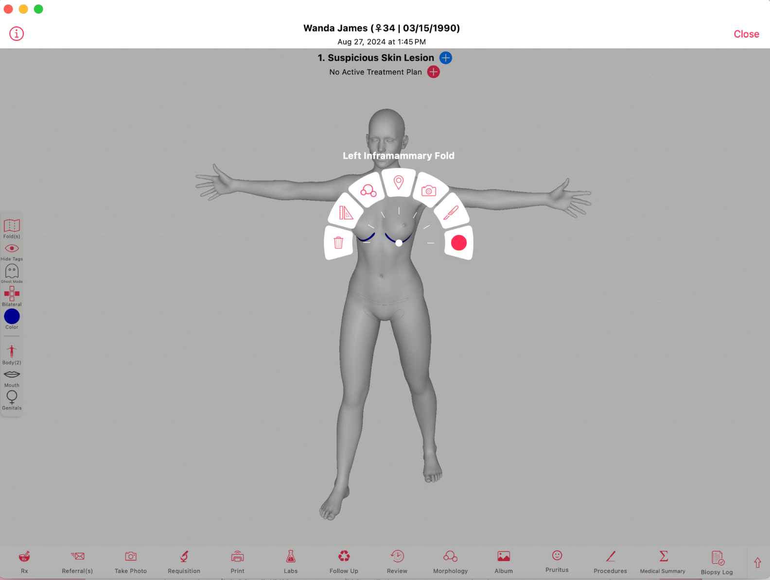 Body Map Example Why 3D Body Maps Are Changing Dermatology Documentation