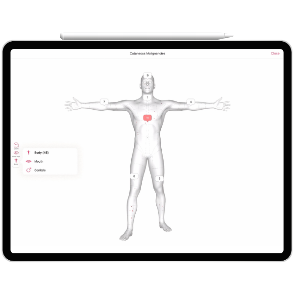 Ezderm Products – EHR – 3D Body Map